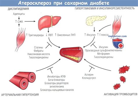 Осложнения поражения сосудов при сахарном диабете