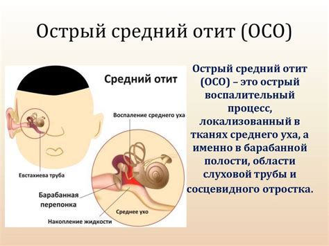 Осложнения после острого и хронического среднего отита