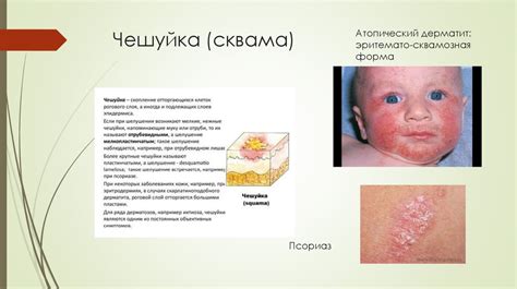 Осложнения сыпи от аллергии