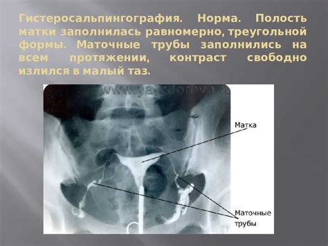 Основания ГСГ исследования труб