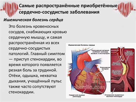 Основные заболевания ларингофона