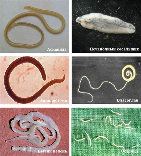 Основные методы определения и признаки видов глистов у человека