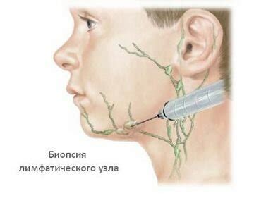 Основные методы прощупывания лимфоузлов в паху