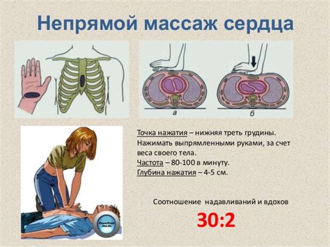 Основные правила безопасного проведения искусственного дыхания