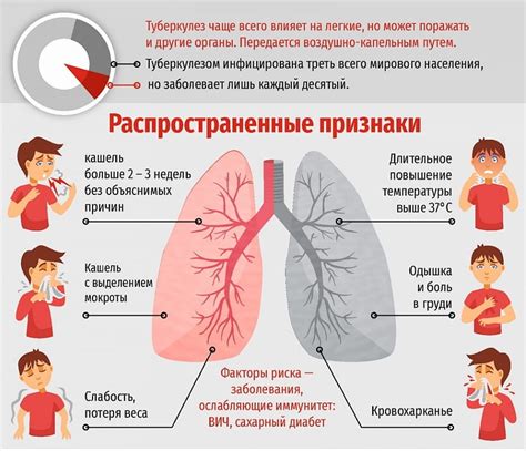 Основные признаки и симптомы туберкулеза