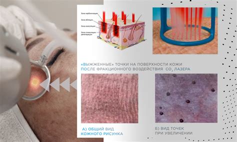 Основные применения СО2 лазера