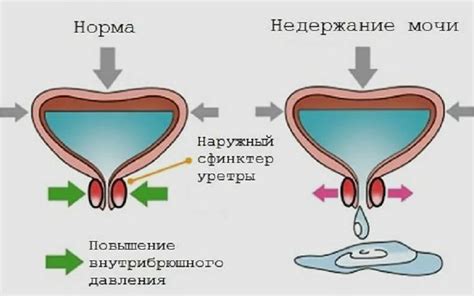 Основные причины гула ног в ночное время у женщин