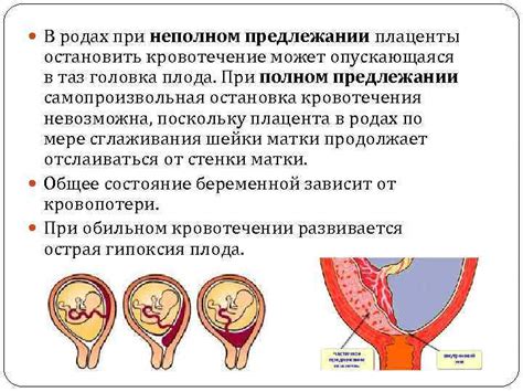 Основные причины для кесарева при низкой плацентации