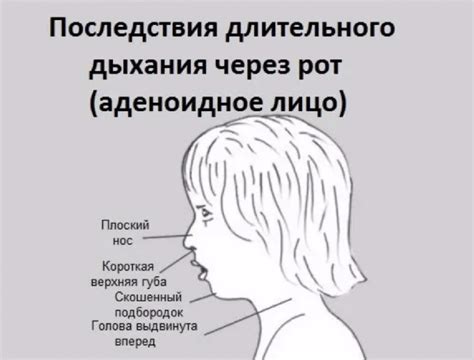 Основные причины дыхания через рот