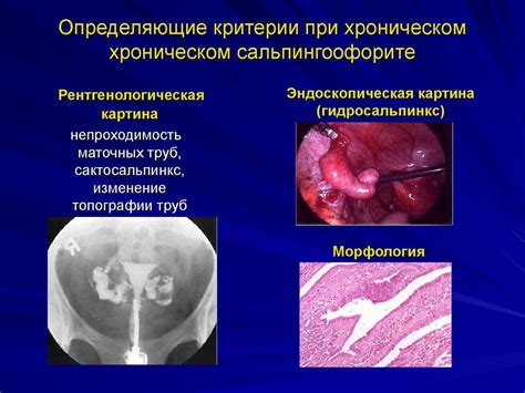 Основные причины заболевания и замещение очищения женских труб