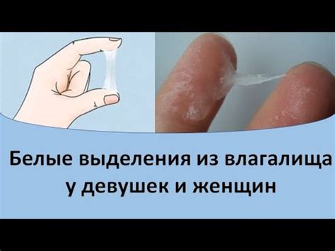 Основные причины появления ежедневных выделений у девушек