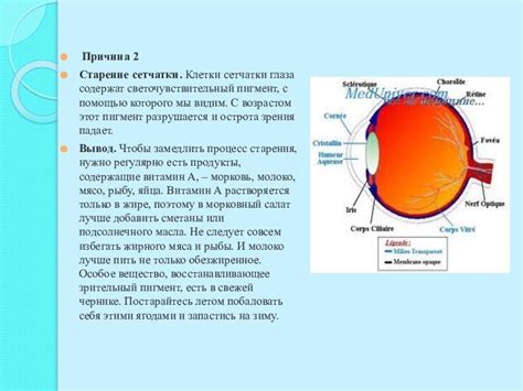 Основные причины снижения зрения у подростков