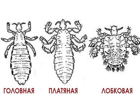 Основные пути передачи вшей