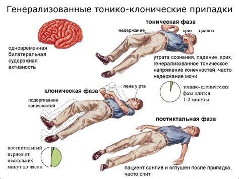 Основные симптомы и последствия судорог