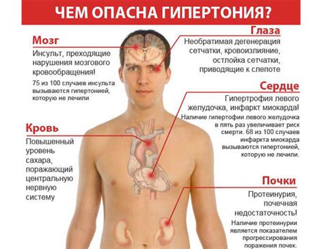 Основные симптомы повышенной температуры при гипертонии