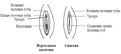 Основы гигиены половых губ