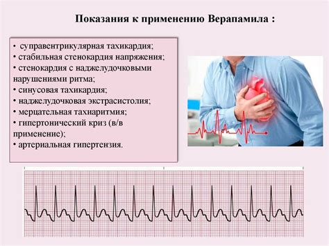 Особенности аритмии