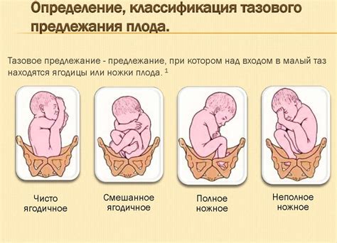 Особенности определения вида и позиции плода в разное время беременности