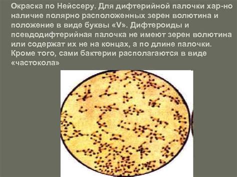 Особенности структуры зерен волютина