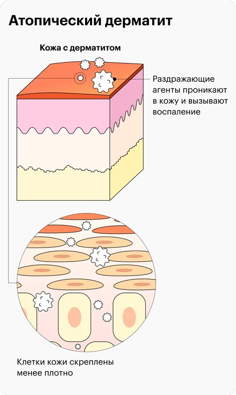 Осторожное и аккуратное вытирание кожи