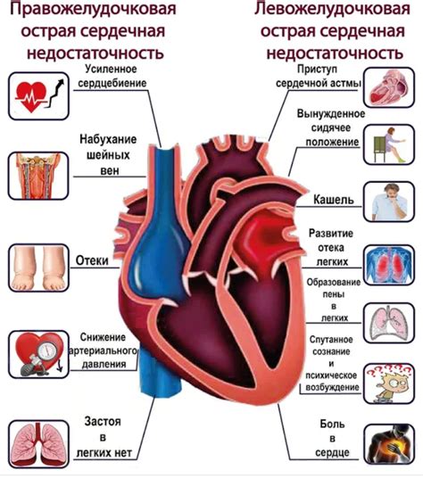 Острая или хроническая сердечная недостаточность