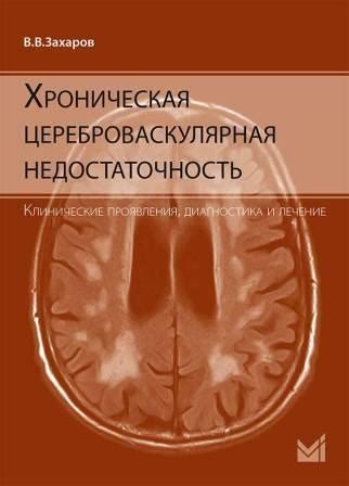 Острая цереброваскулярная недостаточность