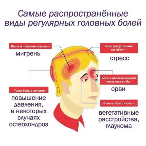 Острый головной боль в висках