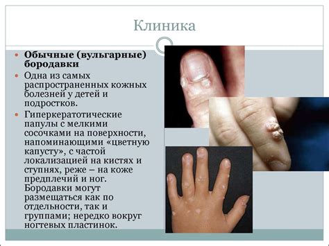 Осушение кожи и слизистых оболочек