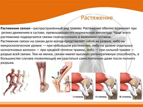 Отеки и синяки: признаки растяжения мышц