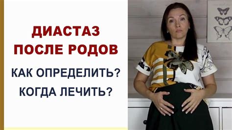 Отзывы о восстановлении тонуса живота после родов