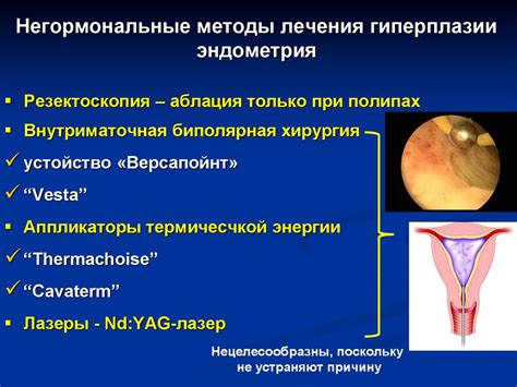 Отзывы пациентов о Дюфастоне при гиперплазии эндометрия