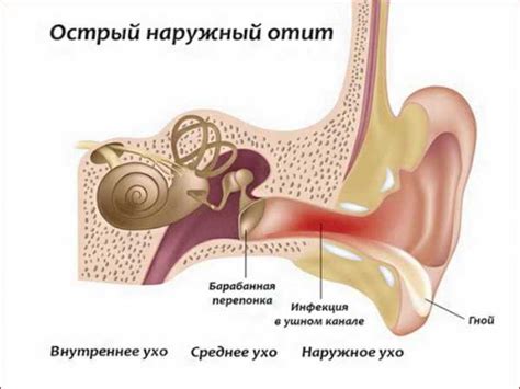 Отит уха: можно ли мочься при данном заболевании