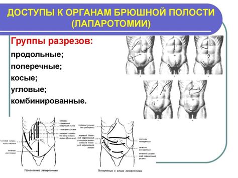 Отсутствие доступа к внутренним органам через раковину