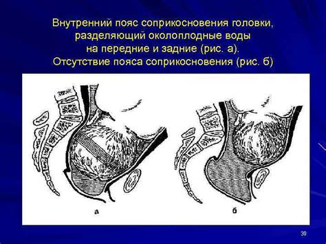 Отсутствие манеры соприкосновения