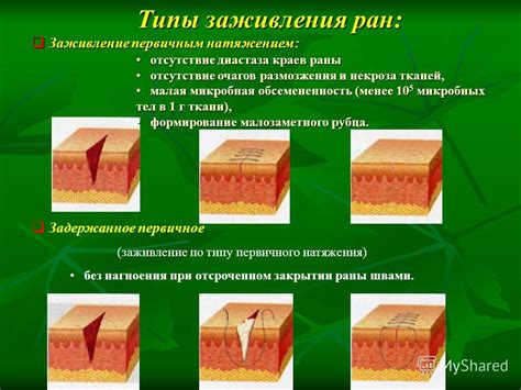 Отсутствие эффекта заживления