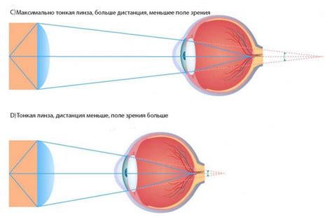 Оценка качества зрения: что следует учитывать