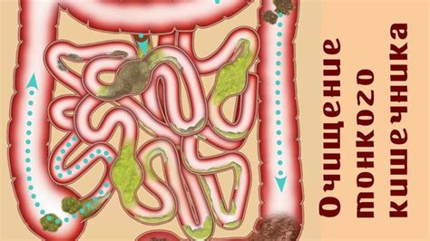 Очищение кишечника: проверенные способы