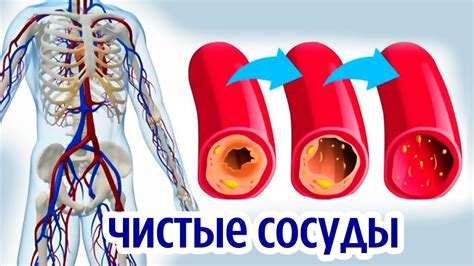 Очищение сосудов: необходимость