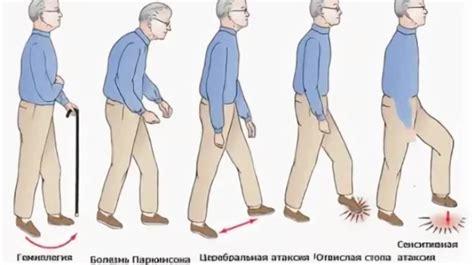 Ошибки в координации движений