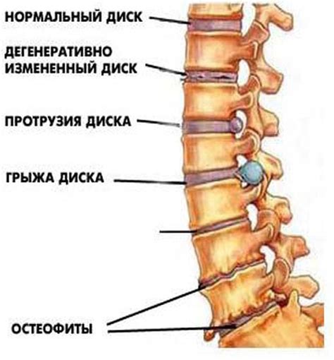 Пальцевое определение шейки позвоночника