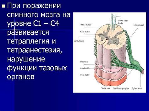 Параличи и их связь с повреждением спинного мозга