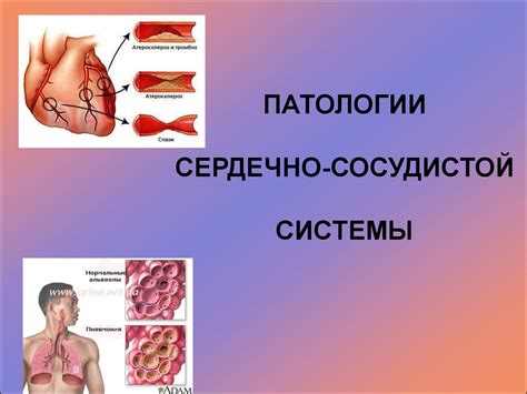 Патологии сердечно-сосудистой системы