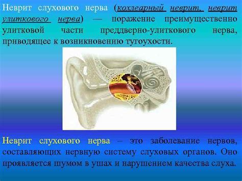 Патологии слухового нерва