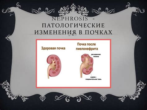 Патологические процессы в почках