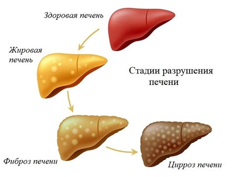 Патологические состояния печени