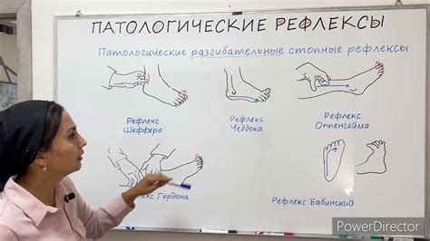 Паучьи рефлексы