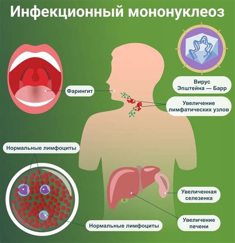 Первая помощь при боли в горле: эффективные способы облегчения состояния