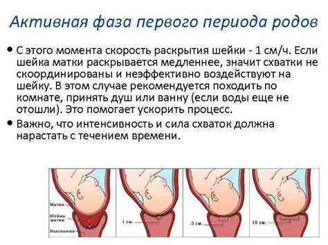 Первая фаза родов с широким тазом: подготовка