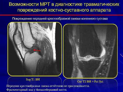 Первоначальная диагностика повреждений