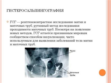 Первый метод лечения заполнения маточных труб